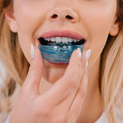 ortodont, diş teli, şeffaf plak tedavisi nedir, nasıl yapılır, fiyatları istanbul