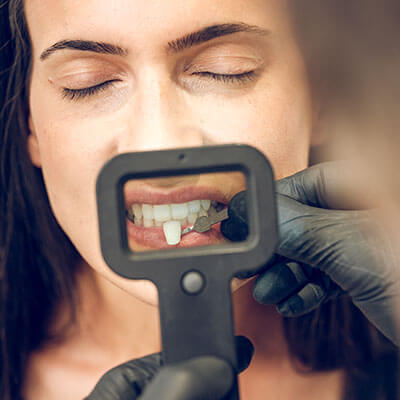 Laminate Veneers Dentistry